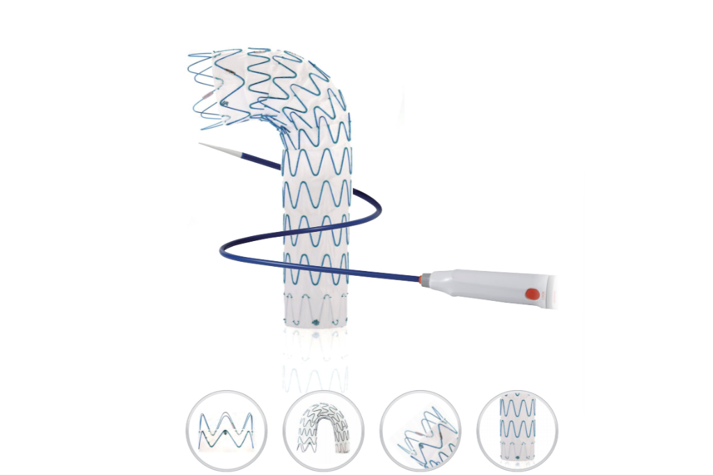 Thoracic Aortic Stent Graft System: Top Options for Aortic Aneurysm Repair